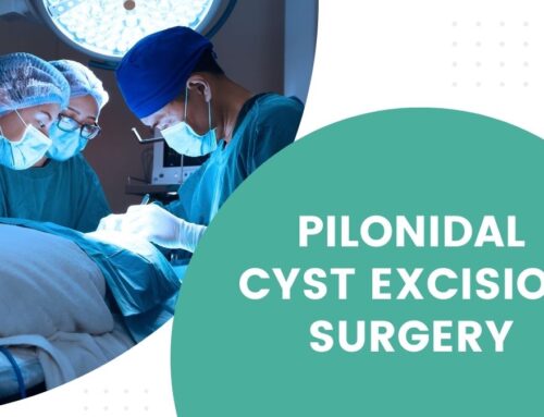 From Discomfort to Recovery: Understanding Pilonidal Cyst Removal